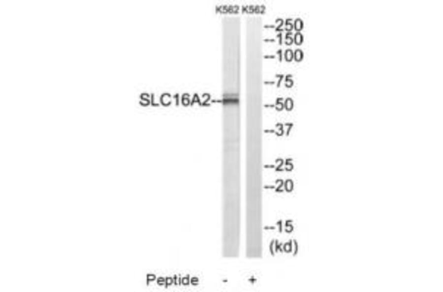 Western blot - SLC16A2 Antibody from Signalway Antibody (34808) - Antibodies.com