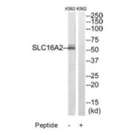 Western blot - SLC16A2 Antibody from Signalway Antibody (34808) - Antibodies.com