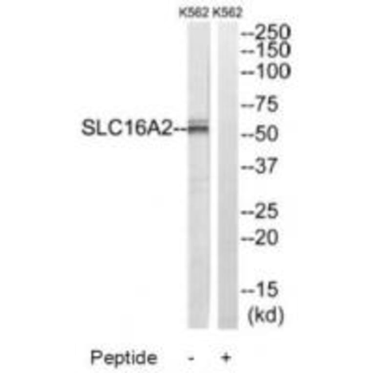 Western blot - SLC16A2 Antibody from Signalway Antibody (34808) - Antibodies.com