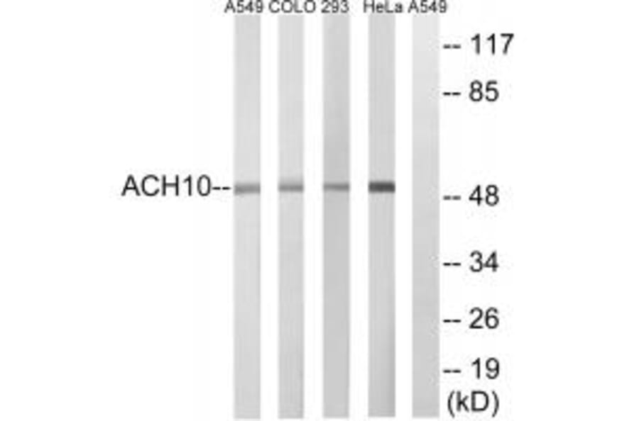 Western blot - CHRNA10 Antibody from Signalway Antibody (34857) - Antibodies.com