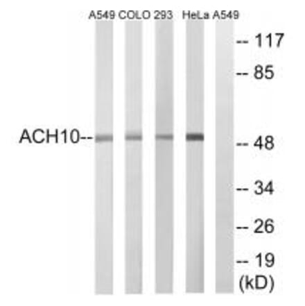 Western blot - CHRNA10 Antibody from Signalway Antibody (34857) - Antibodies.com