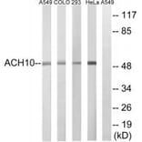 Western blot - CHRNA10 Antibody from Signalway Antibody (34857) - Antibodies.com