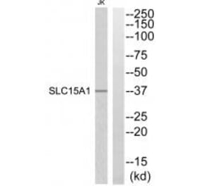 Western blot - SLC15A1 Antibody from Signalway Antibody (34879) - Antibodies.com