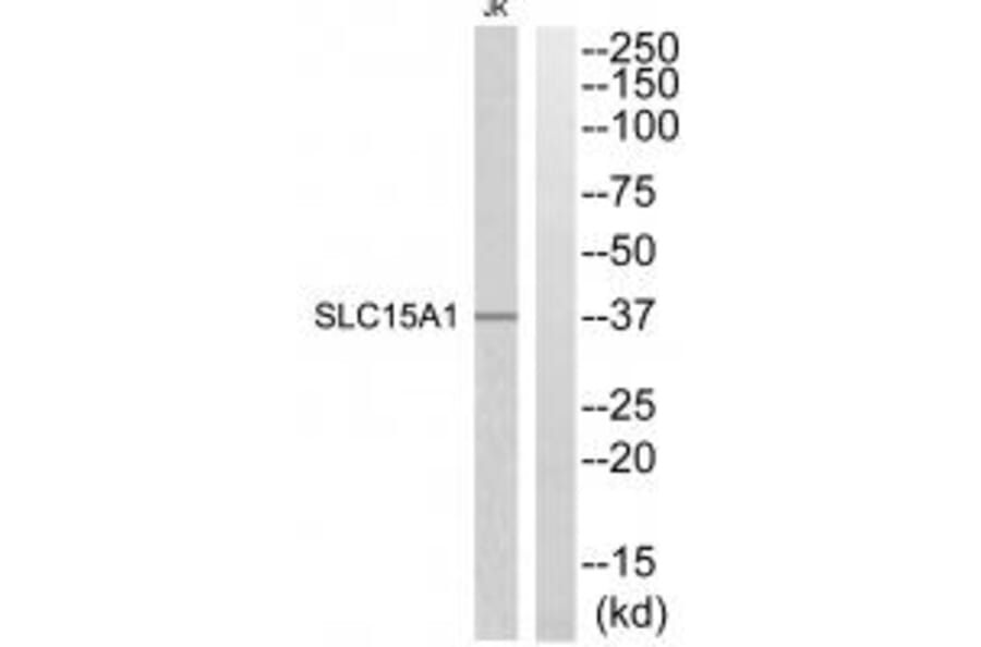 Western blot - SLC15A1 Antibody from Signalway Antibody (34879) - Antibodies.com