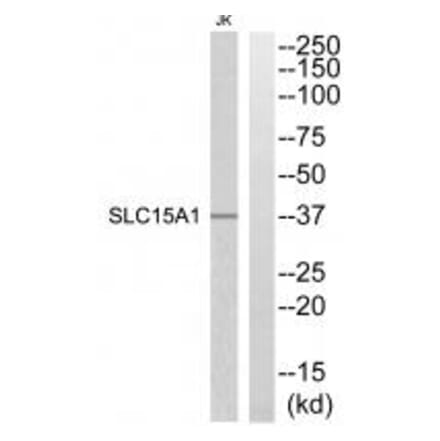 Western blot - SLC15A1 Antibody from Signalway Antibody (34879) - Antibodies.com