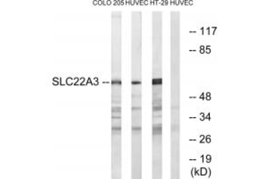 Western blot - SLC22A3 Antibody from Signalway Antibody (34881) - Antibodies.com