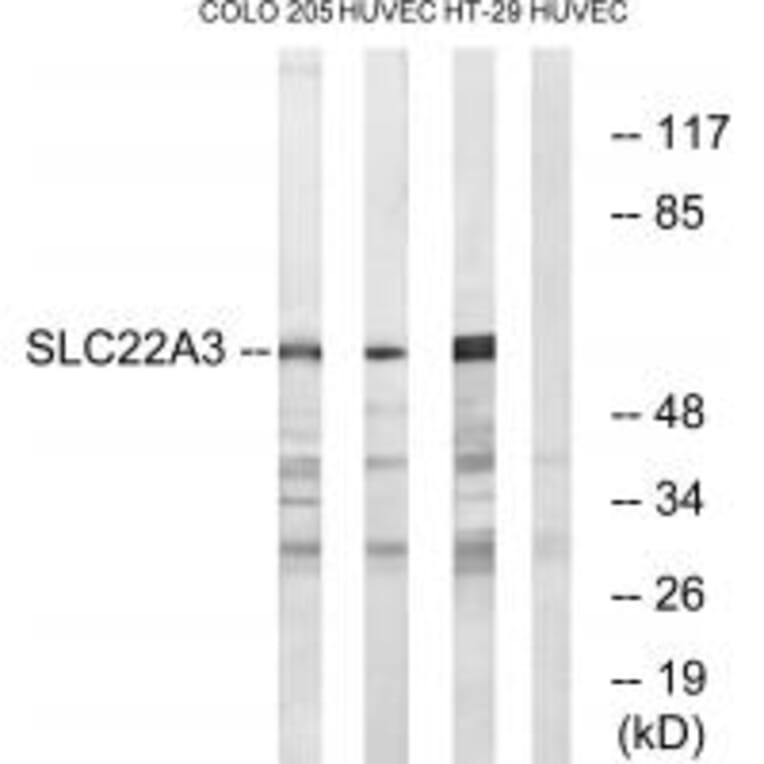 Western blot - SLC22A3 Antibody from Signalway Antibody (34881) - Antibodies.com