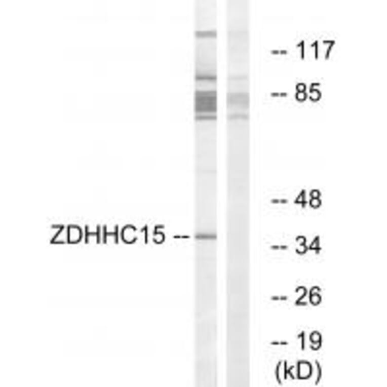 Western blot - ZDHHC15 Antibody from Signalway Antibody (34887) - Antibodies.com
