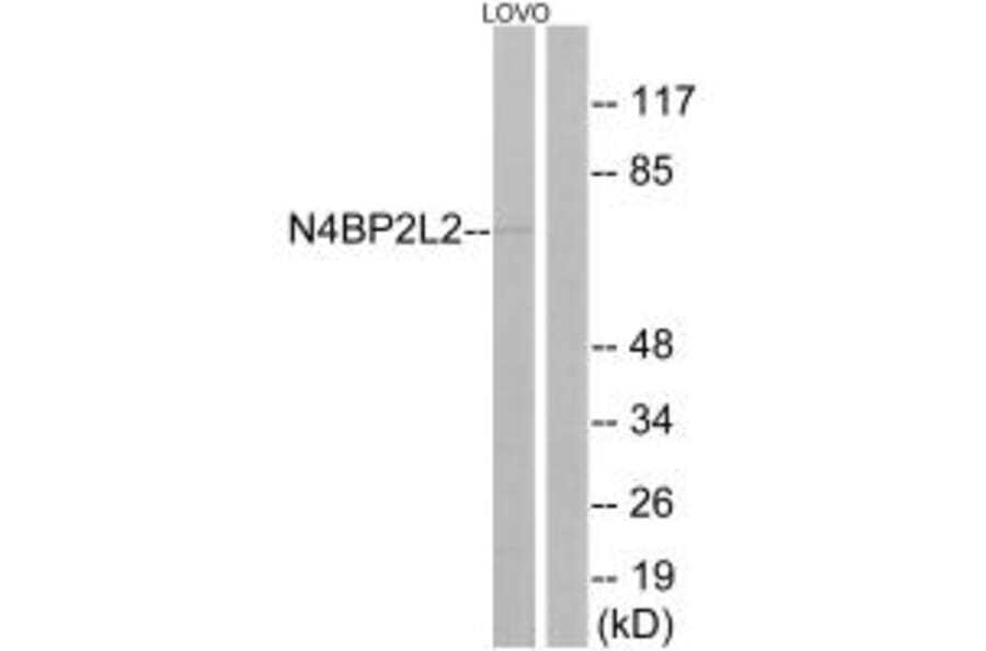 Western blot - N4BP2L2 Antibody from Signalway Antibody (34906) - Antibodies.com