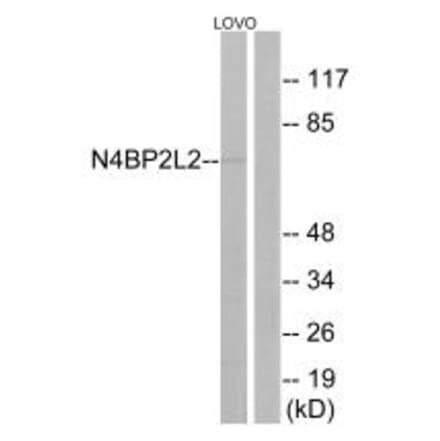 Western blot - N4BP2L2 Antibody from Signalway Antibody (34906) - Antibodies.com