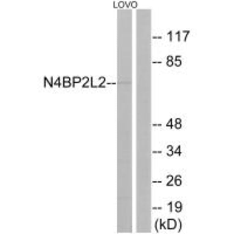 Western blot - N4BP2L2 Antibody from Signalway Antibody (34906) - Antibodies.com
