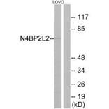 Western blot - N4BP2L2 Antibody from Signalway Antibody (34906) - Antibodies.com