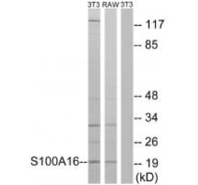 Western blot - S100A16 Antibody from Signalway Antibody (34936) - Antibodies.com