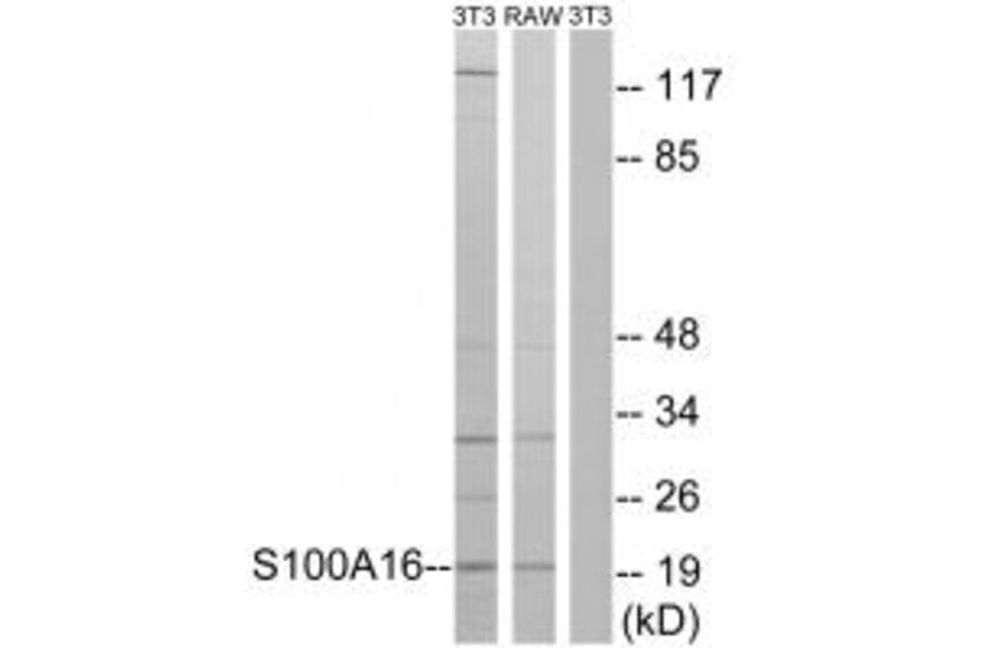 Western blot - S100A16 Antibody from Signalway Antibody (34936) - Antibodies.com