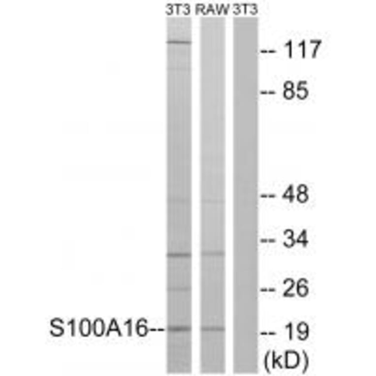 Western blot - S100A16 Antibody from Signalway Antibody (34936) - Antibodies.com