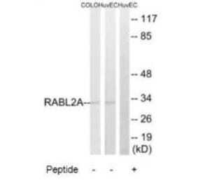 Western blot - RABL2A Antibody from Signalway Antibody (34952) - Antibodies.com