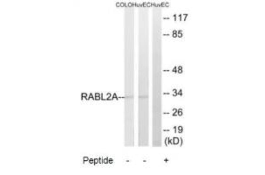 Western blot - RABL2A Antibody from Signalway Antibody (34952) - Antibodies.com
