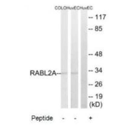 Western blot - RABL2A Antibody from Signalway Antibody (34952) - Antibodies.com