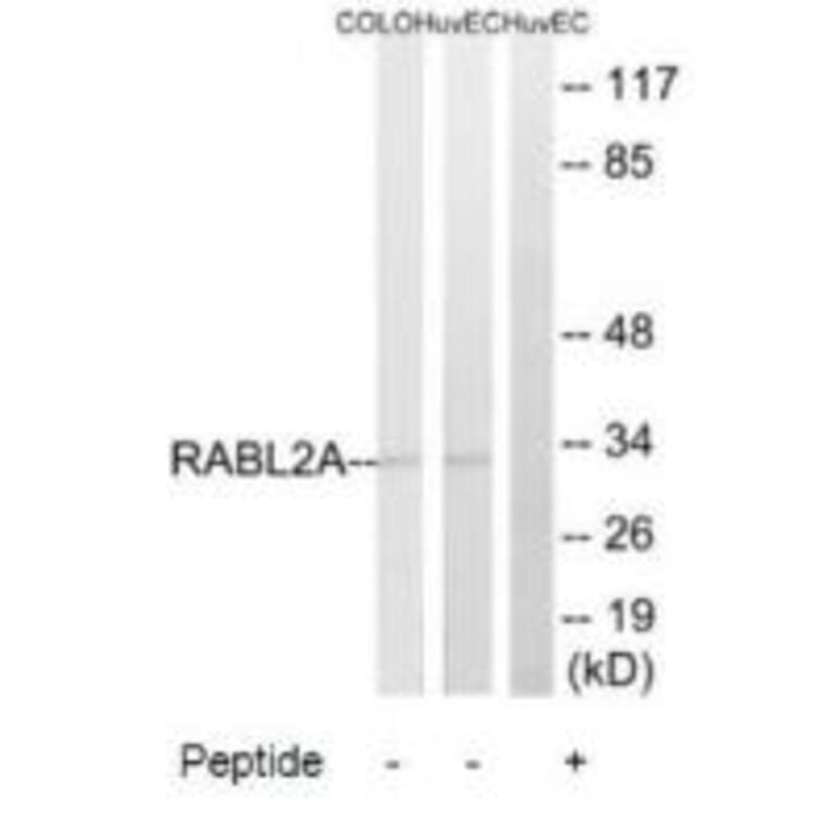 Western blot - RABL2A Antibody from Signalway Antibody (34952) - Antibodies.com