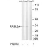 Western blot - RABL2A Antibody from Signalway Antibody (34952) - Antibodies.com