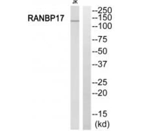 Western blot - RANBP17 Antibody from Signalway Antibody (34957) - Antibodies.com