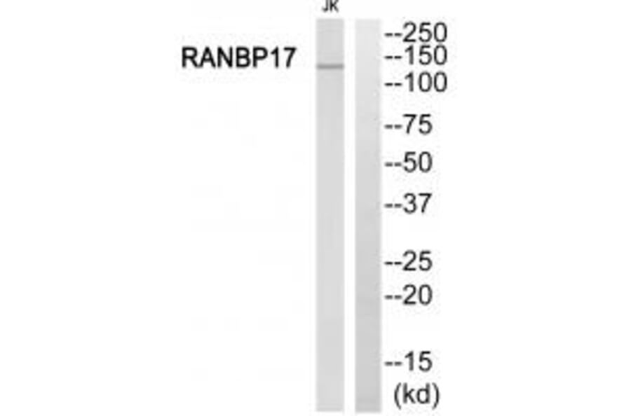 Western blot - RANBP17 Antibody from Signalway Antibody (34957) - Antibodies.com