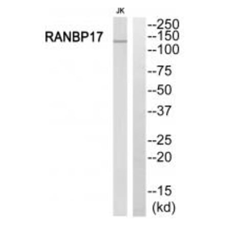 Western blot - RANBP17 Antibody from Signalway Antibody (34957) - Antibodies.com