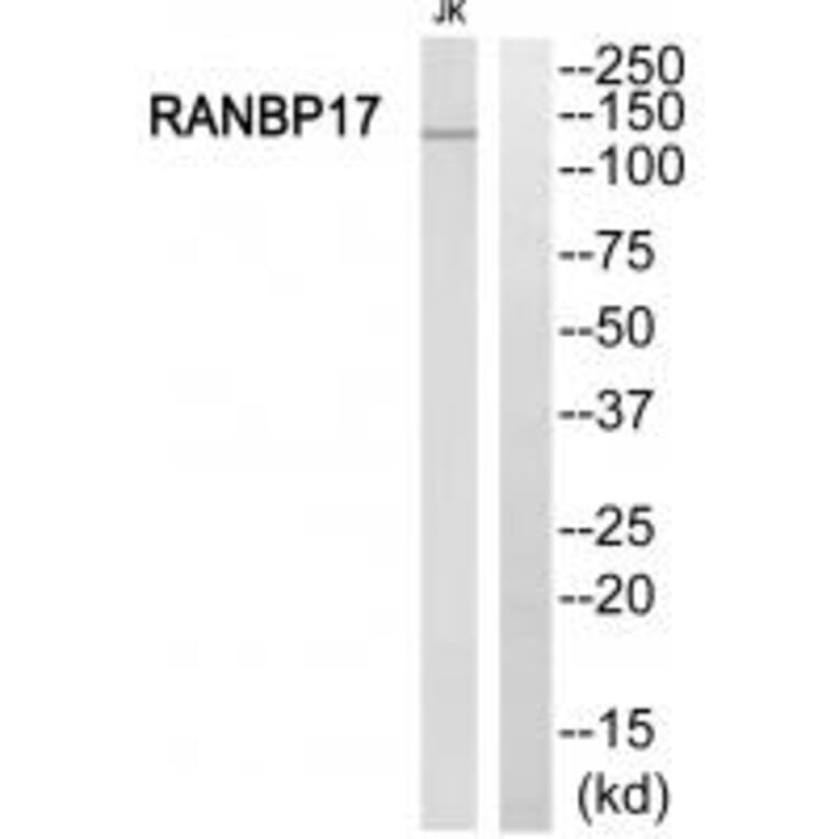Western blot - RANBP17 Antibody from Signalway Antibody (34957) - Antibodies.com