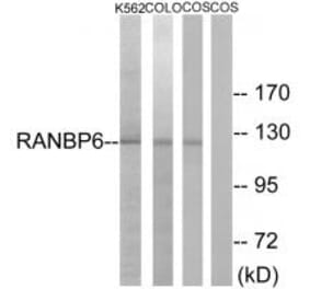 Western blot - RANBP6 Antibody from Signalway Antibody (34958) - Antibodies.com