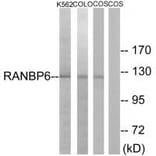 Western blot - RANBP6 Antibody from Signalway Antibody (34958) - Antibodies.com