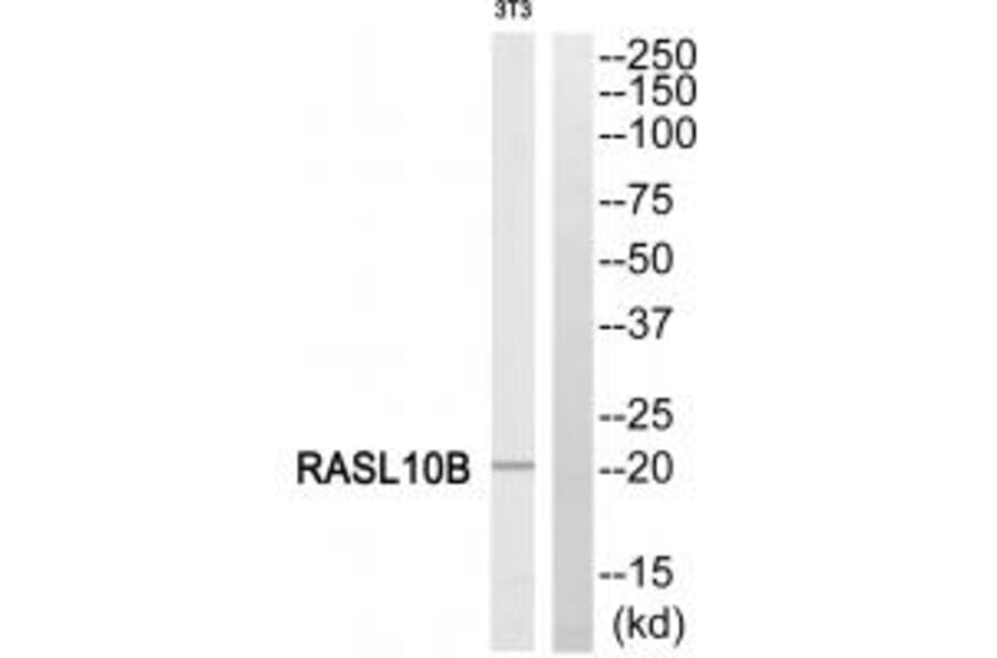 Western blot - RASL10B Antibody from Signalway Antibody (34964) - Antibodies.com