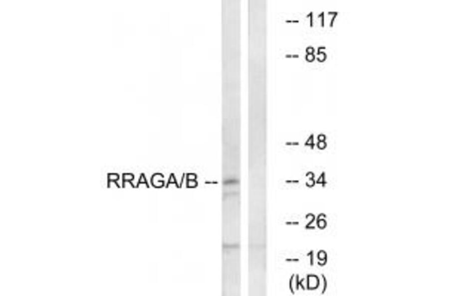 Western blot - RRAGA/B Antibody from Signalway Antibody (34965) - Antibodies.com