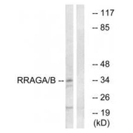 Western blot - RRAGA/B Antibody from Signalway Antibody (34965) - Antibodies.com