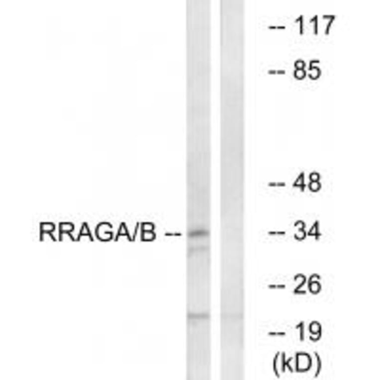 Western blot - RRAGA/B Antibody from Signalway Antibody (34965) - Antibodies.com