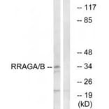 Western blot - RRAGA/B Antibody from Signalway Antibody (34965) - Antibodies.com