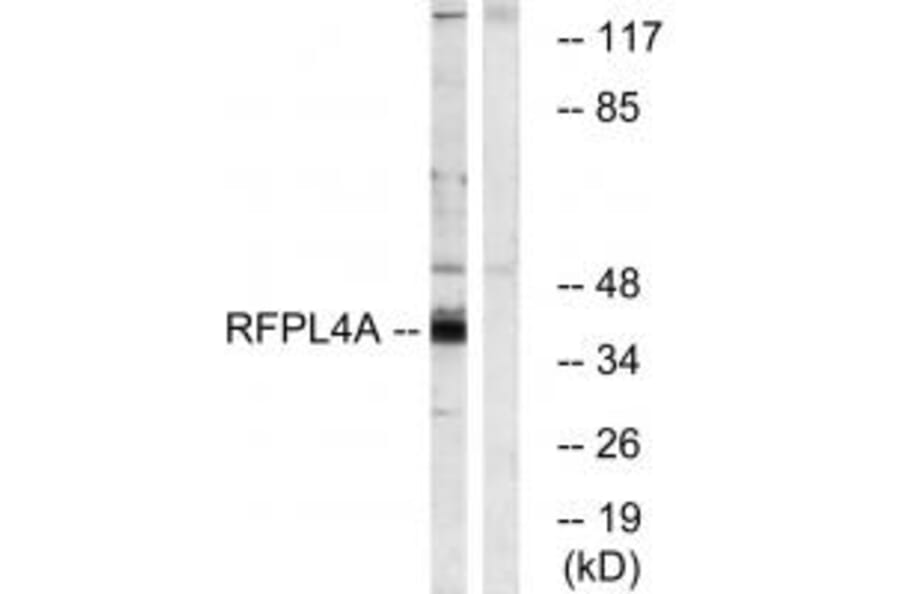 Western blot - RFPL4A Antibody from Signalway Antibody (34985) - Antibodies.com