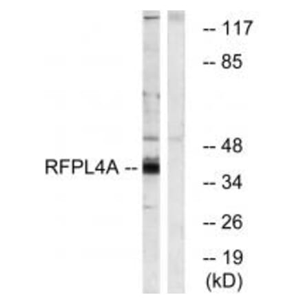 Western blot - RFPL4A Antibody from Signalway Antibody (34985) - Antibodies.com