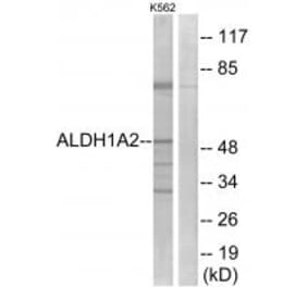 Western blot - ALDH1A2 Antibody from Signalway Antibody (34986) - Antibodies.com