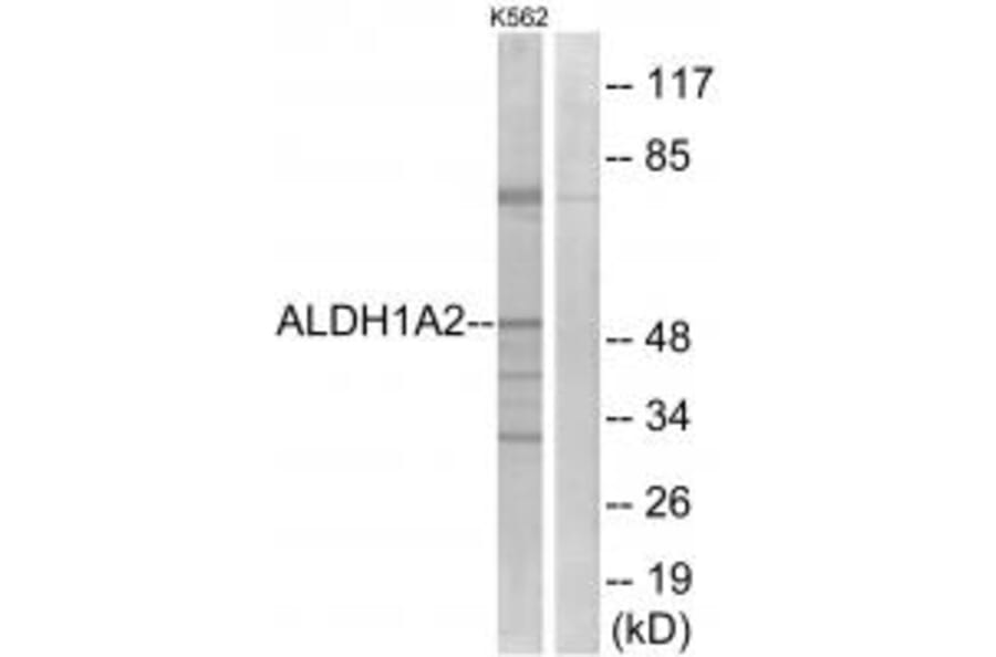 Western blot - ALDH1A2 Antibody from Signalway Antibody (34986) - Antibodies.com