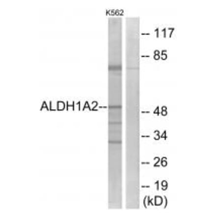 Western blot - ALDH1A2 Antibody from Signalway Antibody (34986) - Antibodies.com