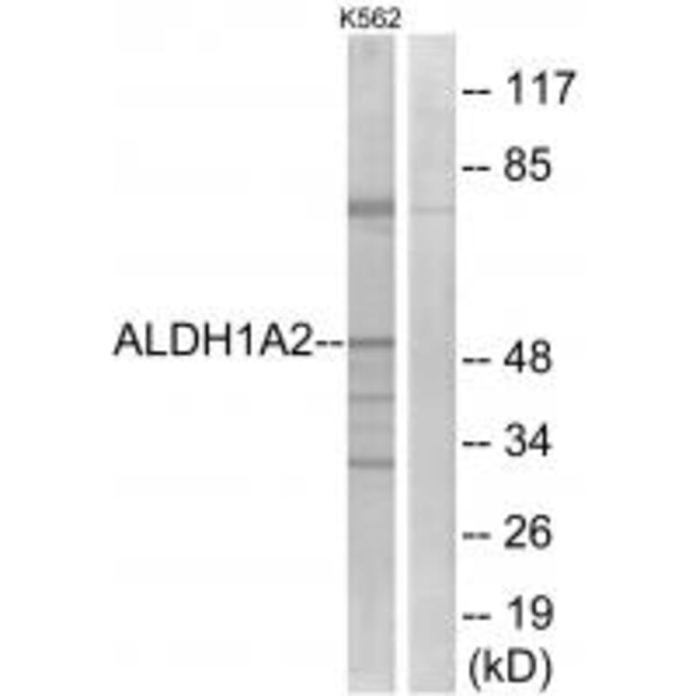 Western blot - ALDH1A2 Antibody from Signalway Antibody (34986) - Antibodies.com