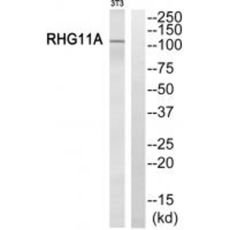 Western blot - RHG11A Antibody from Signalway Antibody (34987) - Antibodies.com