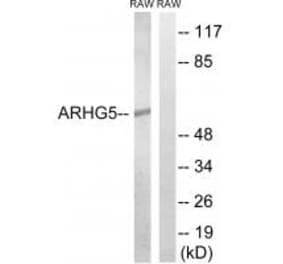 Western blot - ARHGEF5 Antibody from Signalway Antibody (34996) - Antibodies.com
