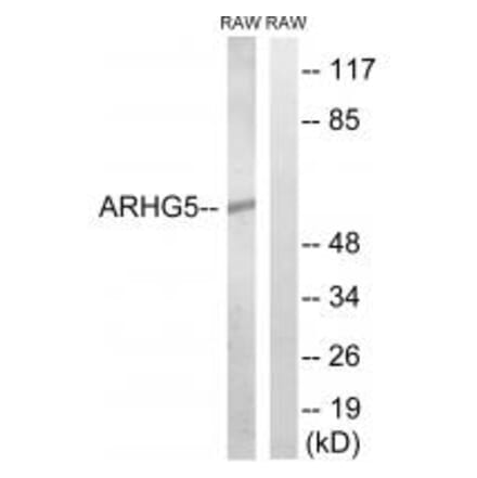 Western blot - ARHGEF5 Antibody from Signalway Antibody (34996) - Antibodies.com