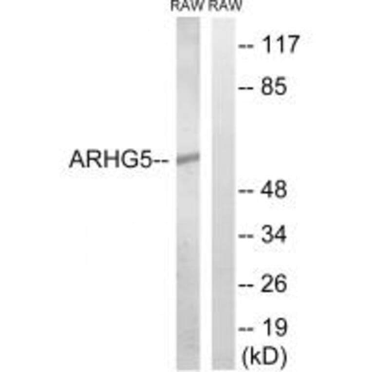Western blot - ARHGEF5 Antibody from Signalway Antibody (34996) - Antibodies.com