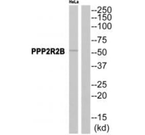 Western blot - PPP2R2B Antibody from Signalway Antibody (35028) - Antibodies.com