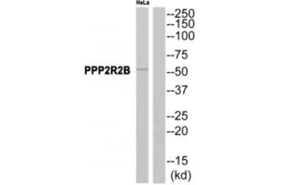 Western blot - PPP2R2B Antibody from Signalway Antibody (35028) - Antibodies.com