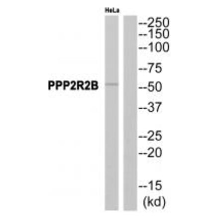 Western blot - PPP2R2B Antibody from Signalway Antibody (35028) - Antibodies.com