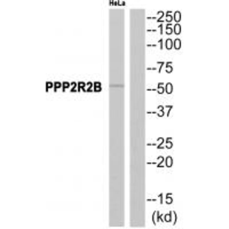 Western blot - PPP2R2B Antibody from Signalway Antibody (35028) - Antibodies.com
