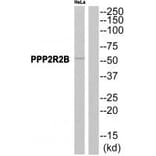 Western blot - PPP2R2B Antibody from Signalway Antibody (35028) - Antibodies.com